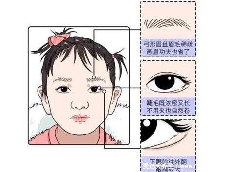歌舞伎综合症宝宝照片 歌舞伎脸谱症蓝妮妮_华夏智能网