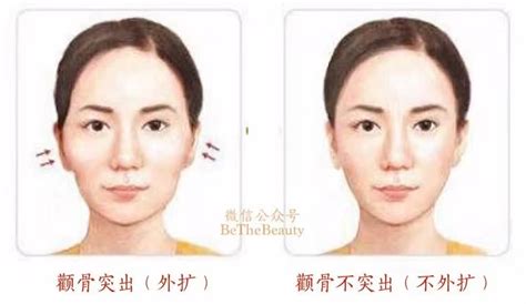 熊黛林颧骨高图片