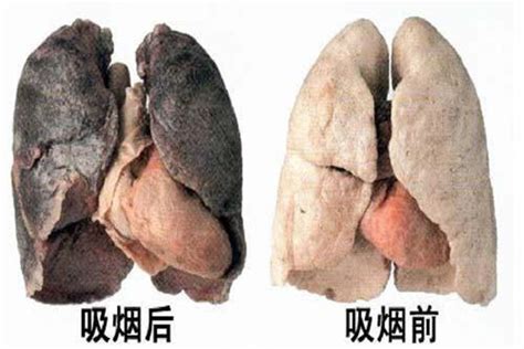 平时注意养肺,远离这4种气体会让你的肺更健康|肺癌|养肺|粉尘_新浪新闻