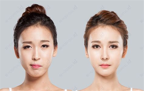 模拟整形_AI整容_人脸建模_3D面部模型美容-羽迹科技app