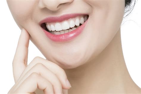牙齿矫正+牙齿贴面，适合大部分的美牙案例