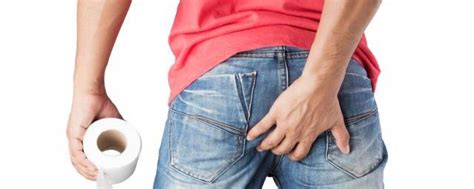 痔疮刚开始图片