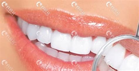 牙贝恩口腔是正规牙科连锁,种植牙/牙齿矫正技术和价格靠谱,种植牙-8682整形网