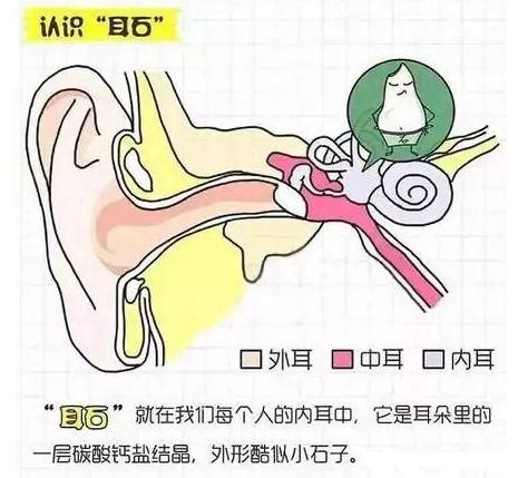 耳石症图片