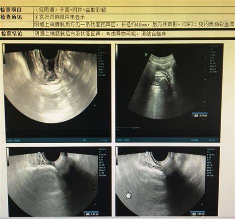 外阴实图图片