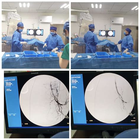 子宫肌瘤介入栓塞3D动画演示，最后几秒很神奇！_腾讯视频