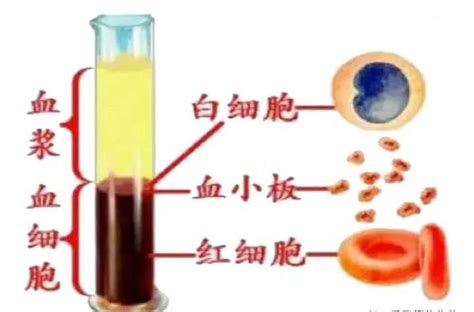血液分层示意图图片