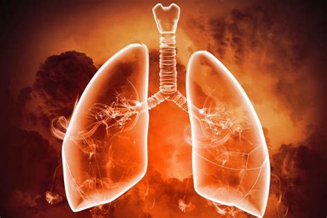 什么是肺癌相关性咳嗽？与慢性咳嗽有什么区别？-京东健康