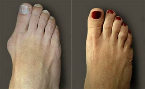 从你脚趾的长度，看你的命运如何？超准|脚趾|指头|大拇指_新浪新闻