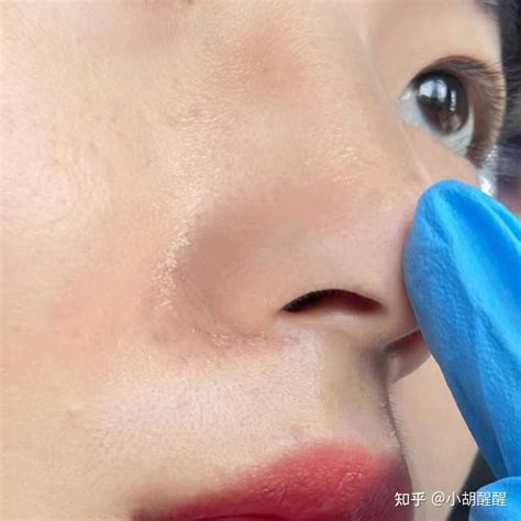 【图】草莓鼻子如何根治呢 你不知道的四个祛除黑头小妙招_草莓鼻子如何根治_伊秀美容网|yxlady.com