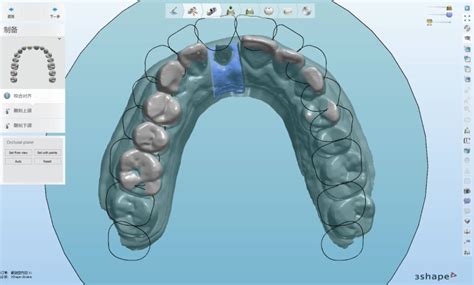 我的口腔管理软件-牙医大川的博客-KQ88口腔博客