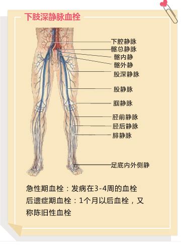 下肢血管解剖图图片