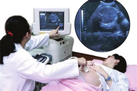 医生用B超查看胎儿的发育情况-初中物理教师网