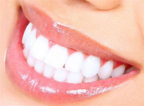 艺美齿美牙培训-我们的牙齿为什么会变黄呢 - 知乎