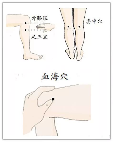 膝眼的准确位置图图片 膝眼的准确位置图图片