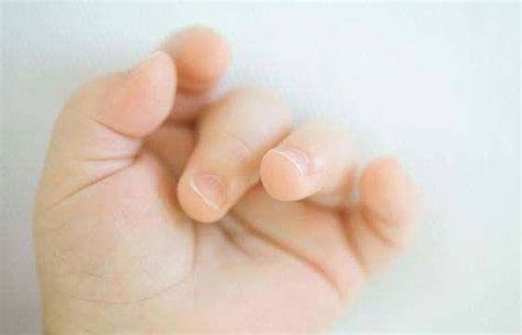 大拇指有月牙象征什么？手指甲的学问你知道多少？跟健康息息相关_影响_身体_症状
