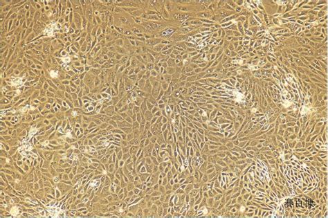 小鼠原代肾小管上皮细胞-原代细胞-STR细胞-细胞培养基-赛百慷生物