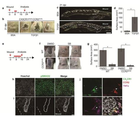 巨噬细胞通过CX3CR1及TGFβ1依赖方式促进创伤诱导的毛囊再生_毛囊再生_医脉通