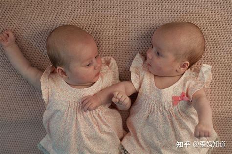 双胞胎姐妹，母亲生下姐姐后，一个月后妹妹才出生，太不容易 - 知乎