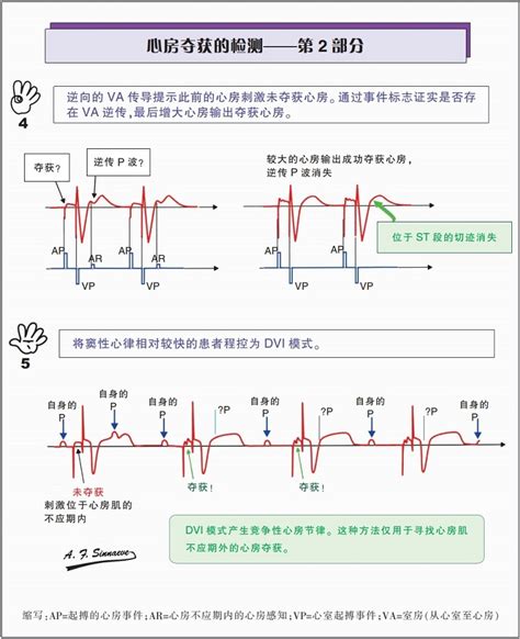 Kelvin KL Wong(黄建龙)研究员在发掘心房颤动机制方面上建立了新的心脏模型--中国科学院广州分院