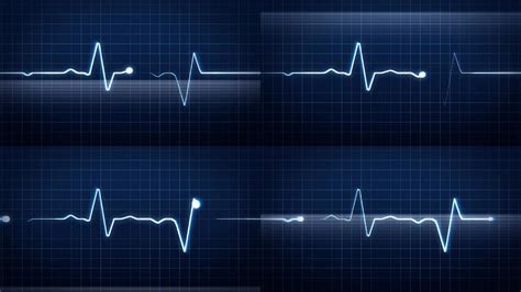 感觉心脏跳动快,但心电图正常（包括24小时的动态心电图）,不知什么原因可引起心跳快？?