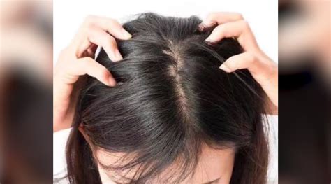 90后年轻人已成植发主力军：每天掉超过100根头发可能是病理性脱发_手机新浪网