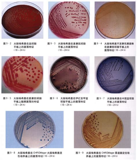 解读GB 4789中的厌氧菌/微需氧菌：高效培养不再是梦-杭州大微生物技术有限公司