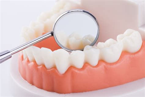 广州种植牙|口腔美学修复中的唇齿关系分析——这样才是好看又好用的种植修复！ - 知乎