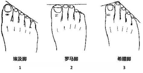 人的脚型分几种（尽量带图）-百度经验