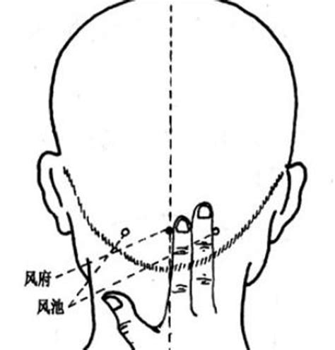 风池的准确位置图图片 风池的准确位置图图片