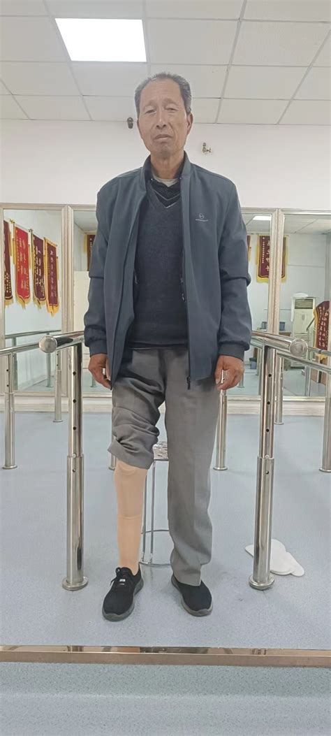 假肢适配助力乡村振兴 康复有爱暖人心--白银市残联为残疾人免费安装假肢