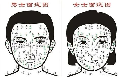 什么是痣图片