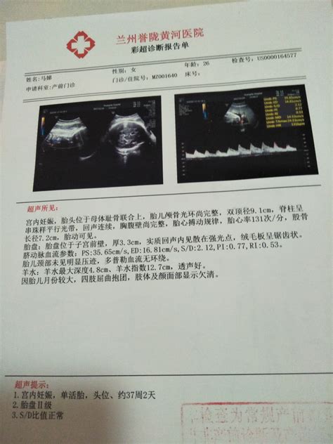 奥特曼b超单图片