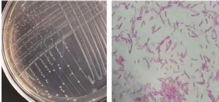 流感嗜血杆菌生化特征-微生物图片-青岛海博生物