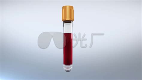 介绍下ABO血型鉴定玻片法凝集结果的判断有哪些_红细胞