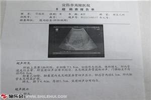 【怀孕b超报告单模板】怀孕三个半月肚子图？b超报告单模板_第二人生