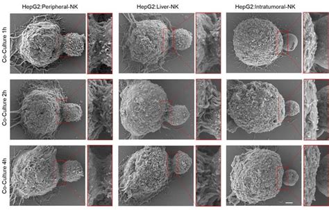 NK-92细胞-淋巴瘤自然杀伤细胞-细胞株购买
