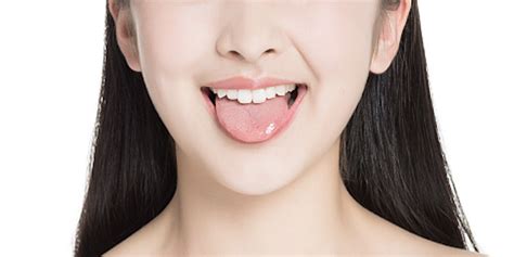 舌苔越干净越好？错！可能暗示你“疾病缠身”！