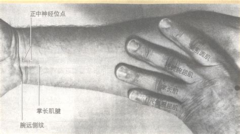 上臂与前臂图解图片