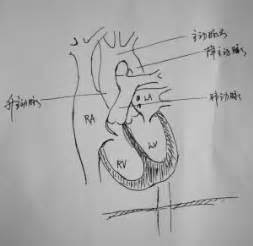 心脏心房心室图简笔画图片