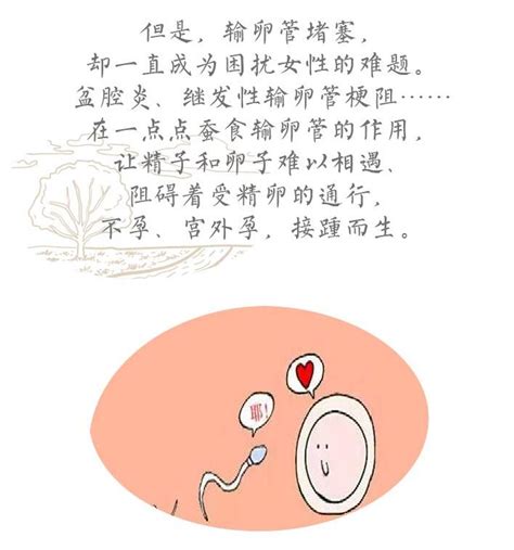 卵蛋网图解图片