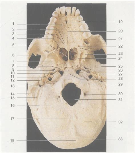 图1—8 颅骨 (底面观)-神经外科解剖学-医学