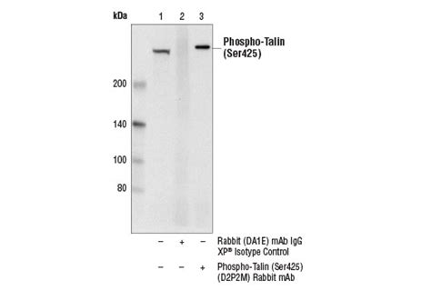 Phospho-Talin (Ser425) (D2P2M) Rabbit mAb | Cell Signaling Technology