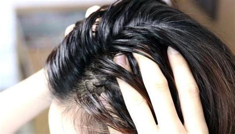 脱发白发头屑头油，四种常见头发问题该如何应对