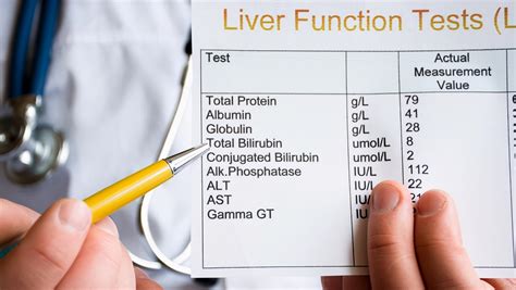 检查肝功能看3类指标，若是没有异常，说明你的肝脏还算健康_凤凰网健康_凤凰网