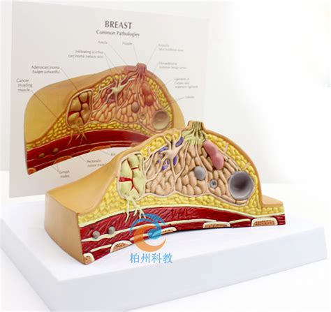 乳房病理解剖模型_上海柏州科教设备有限公司