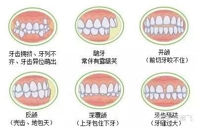 上牙包住下牙正常吗？用一张正常的上下牙咬合图告诉你_辉煌口腔连锁机构