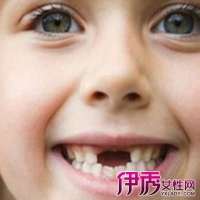 【女人梦见掉牙齿是什么意思】【图】女人梦见掉牙齿是什么意思 周公解梦为你分析各种寓意(3)_伊秀星座|yxlady.com