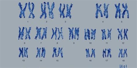 (1)从图中可以看出人类染色体共有 对.(2)从染色体形态组成来看.表示女性染色体的是 图.男性染色体组成可以写成 ——青夏教育精英家教网——