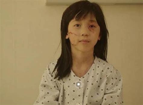 韩国最美童星金所炫颜值急速下滑，20岁就被法令纹下垂缠身！ - 知乎